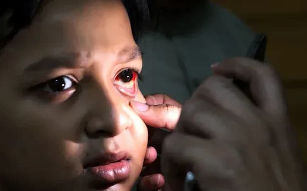 Doctor examining a child's eye using a light to check for any issues.