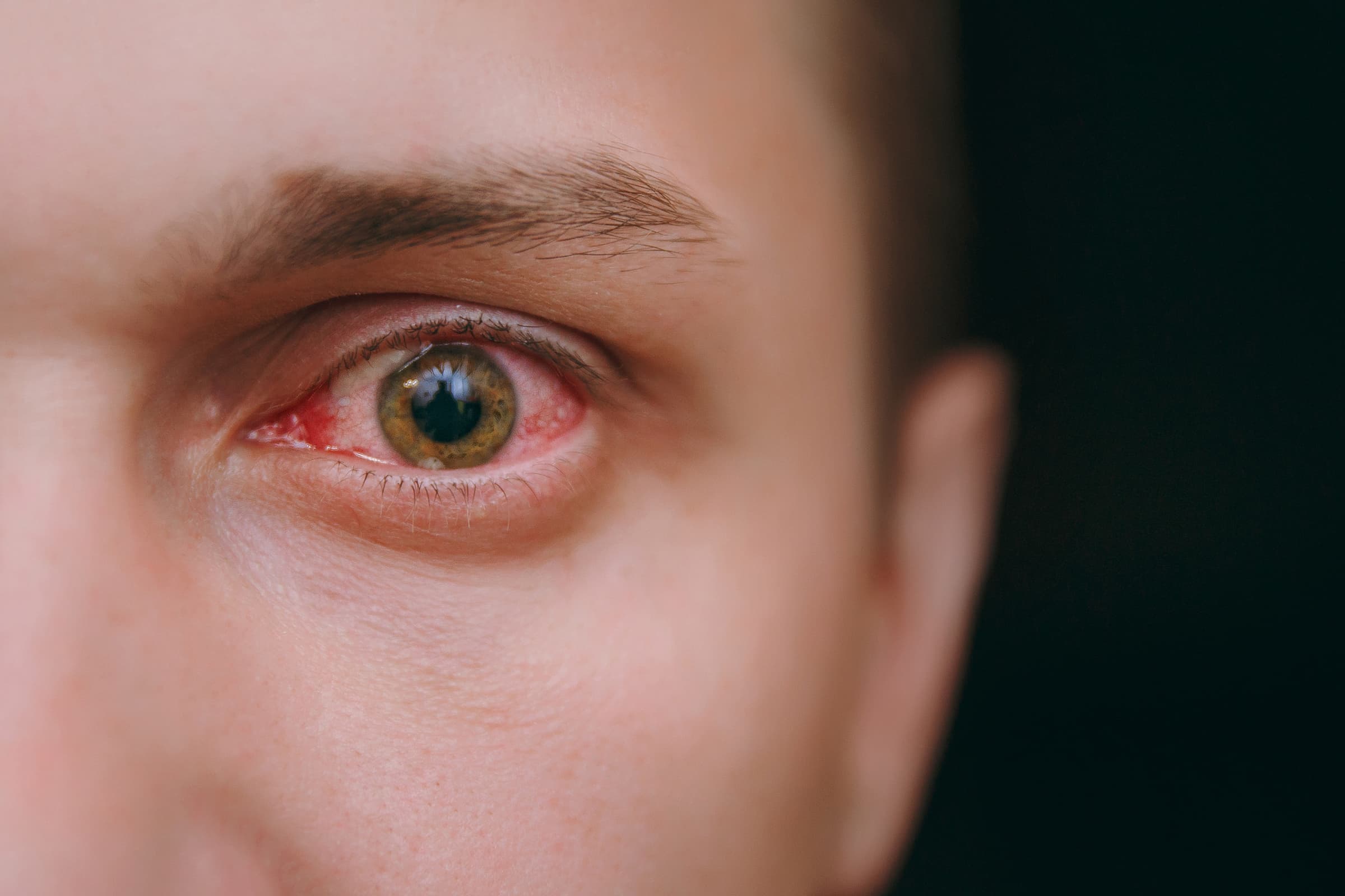 Diabetic Experts You Can Trust at POB Eye Care Diabetic Eye Care